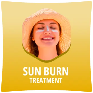 Sun Burn Treatment